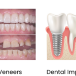 layanan dental